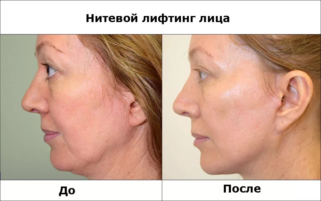 Захаров Антон Игоревич