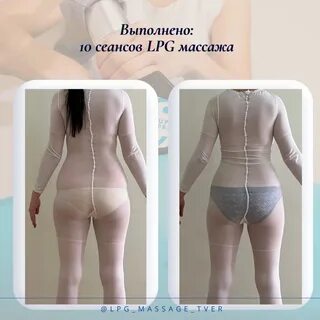 Lpg массаж отзывы реальных людей
