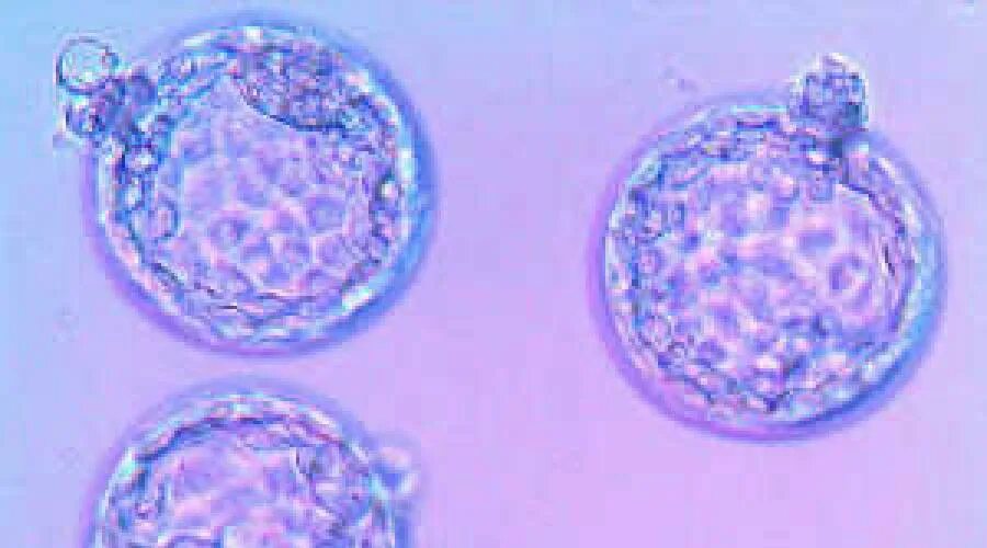 Не приживается эмбрион после эко причины. Бластоциста хетчинг. хетчинг эмбрионов. бластоциста 4 бб на эко. вспомогательный хетчинг.
