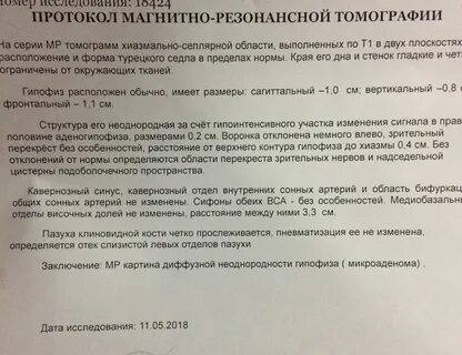Гипофиз заключение