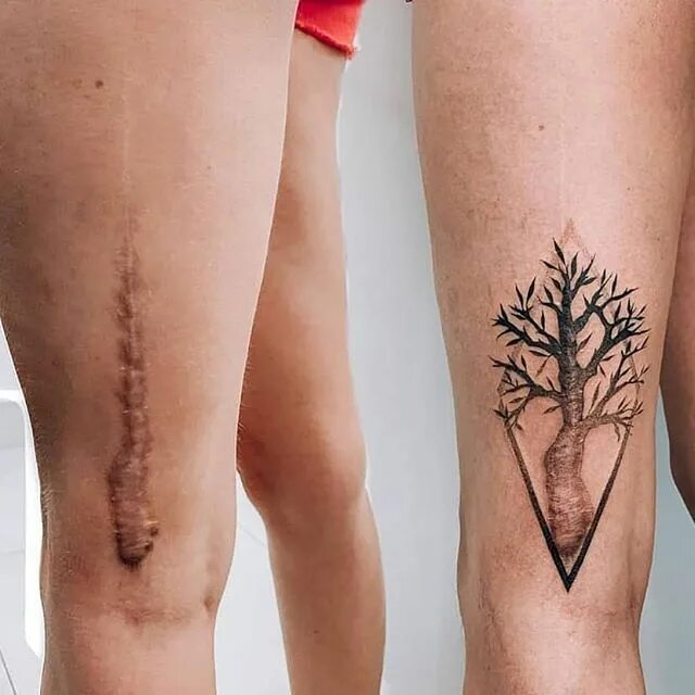 Как выглядит шрам на ноге 24 3-D tattoos that will bend your mind. Amazing 3d tattoos, 3d tattoos, 3d tatt