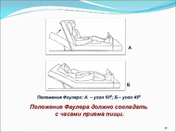 Укладывание пациента в положение Фаулера. Размещение пациента в позе Фаулера. Положение пациента Фаулера и симса. Перемещение пациента в положение Фаулера.