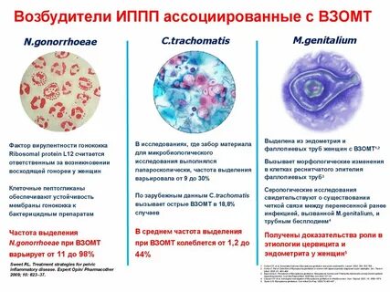 Запах половых инфекций