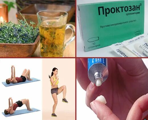 Быстро вылечить геморрой народными средствами. Геморрой лечение в домашних условиях. лечить геморрой в домашних условиях. народные средства от геморроя. лечить геморрой домашним условиям.