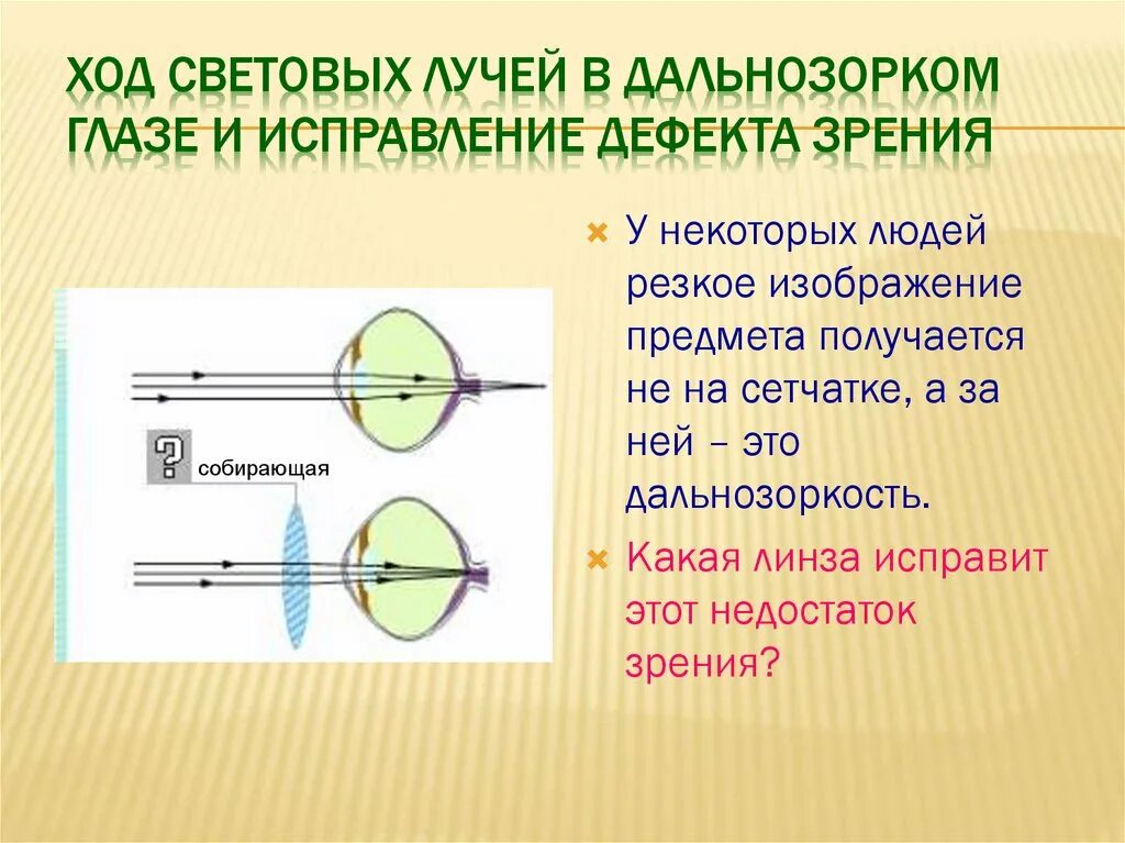 Дополните предложения изображение в близоруком глазу фокусируется