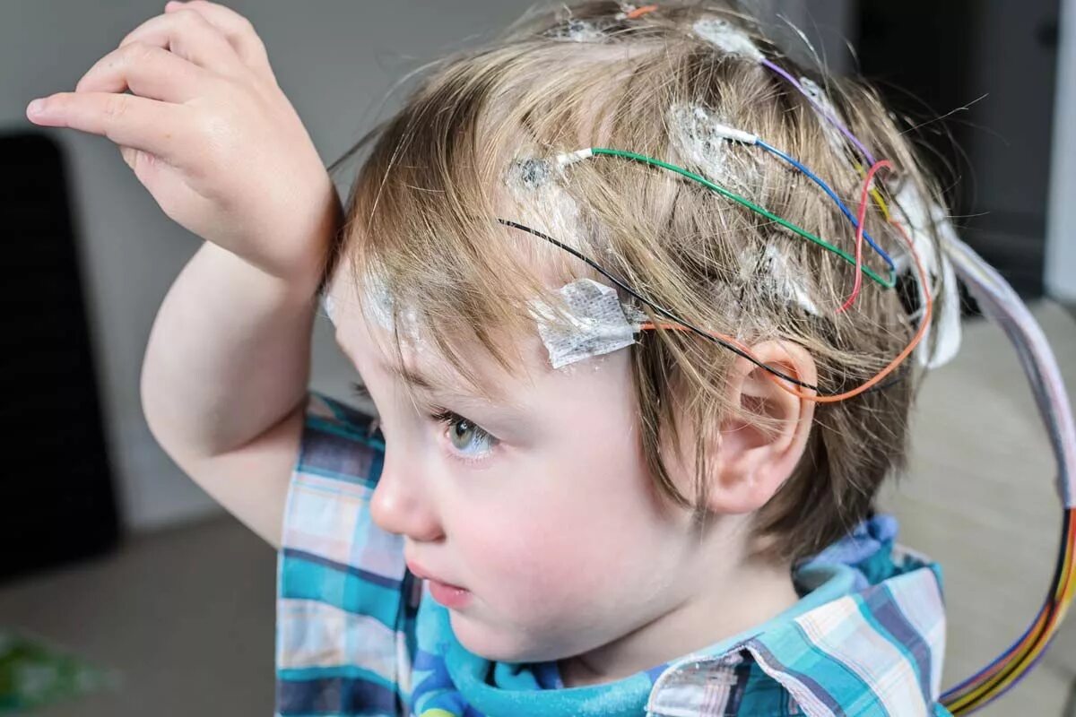 Электроэнцефалография у детей. Мониторинг головы у детей.