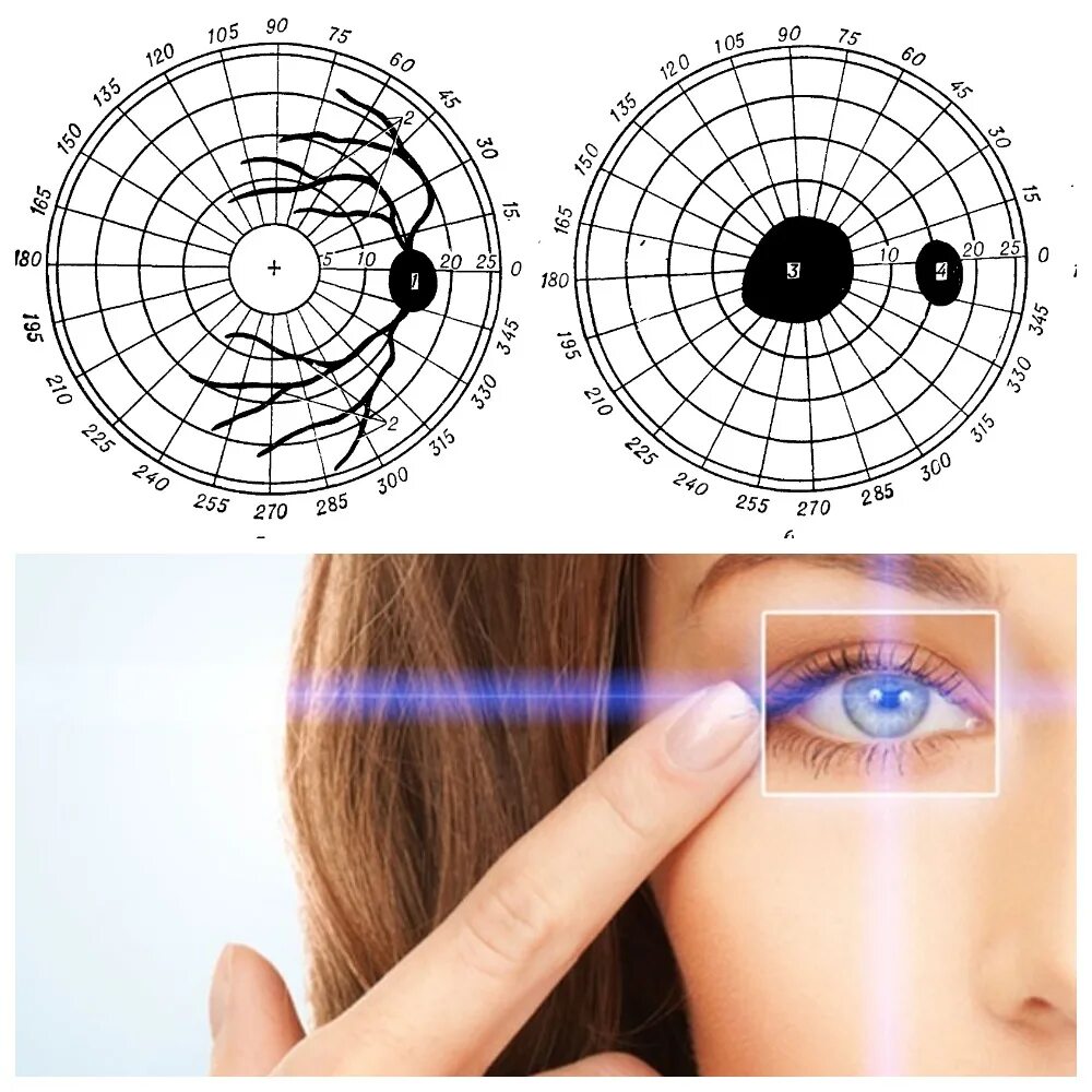 Зона глаз. Слепое пятно зрения человека. Слепые зоны сетчатки глаза. Слепое пятно человеческого глаза. Слепая зона зрения человека.