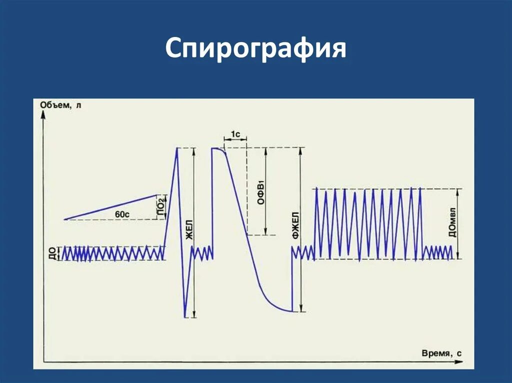 Спирограмма мужчины показала что резервный объем. Офв1 на спирограмме. спирограмма форсированного выдоха. спирограмма жизненной емкости легких. показатели внешнего дыхания спирограмма.