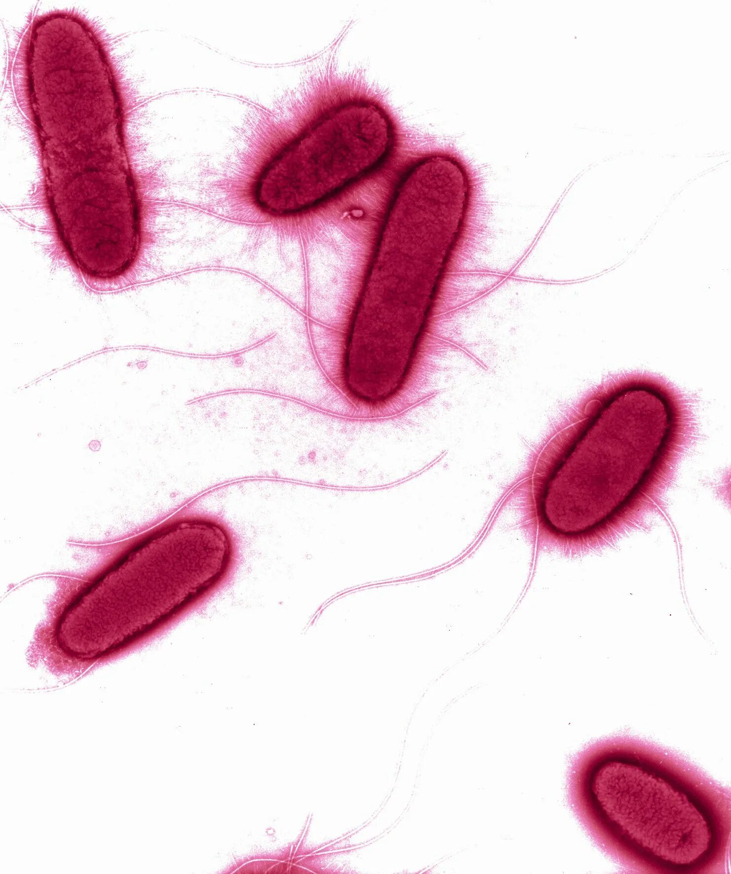 Coli sotwe. Кишечная палочка Escherichia coli. Штаммы кишечной палочки.