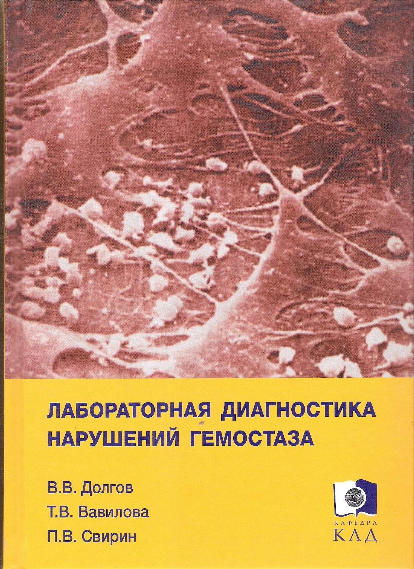 Долгов лабораторная. Лабораторная диагностика нарушений гемостаза. В.В.долгов, п.в. Свирин. Лабораторная диагностика нарушений гемостаза долгов. Лабораторная диагностика нарушений первичного гемостаза. Вавилова "лабораторная диагностика нарушений гемостаза".