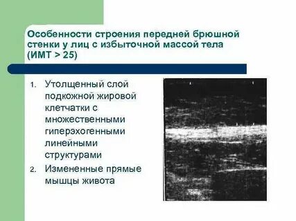 Что значит гиперэхогенный кишечник