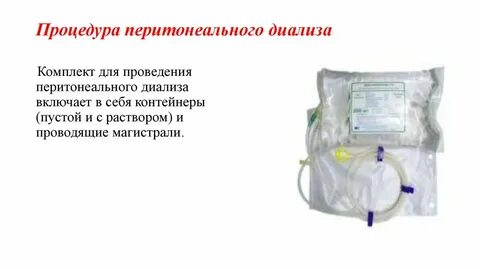 Перитонеальный диализ