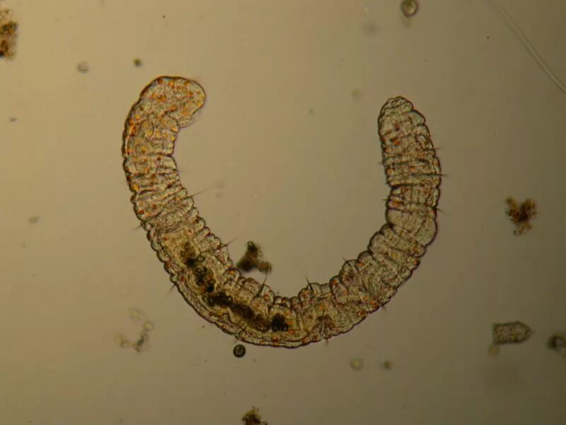 Активный червь. Малощетинковые черви микроскоп. Малощетинковые черви активного ила. Aelosoma Малощетинковые черви. Малощетинковые черви под микроскопом.