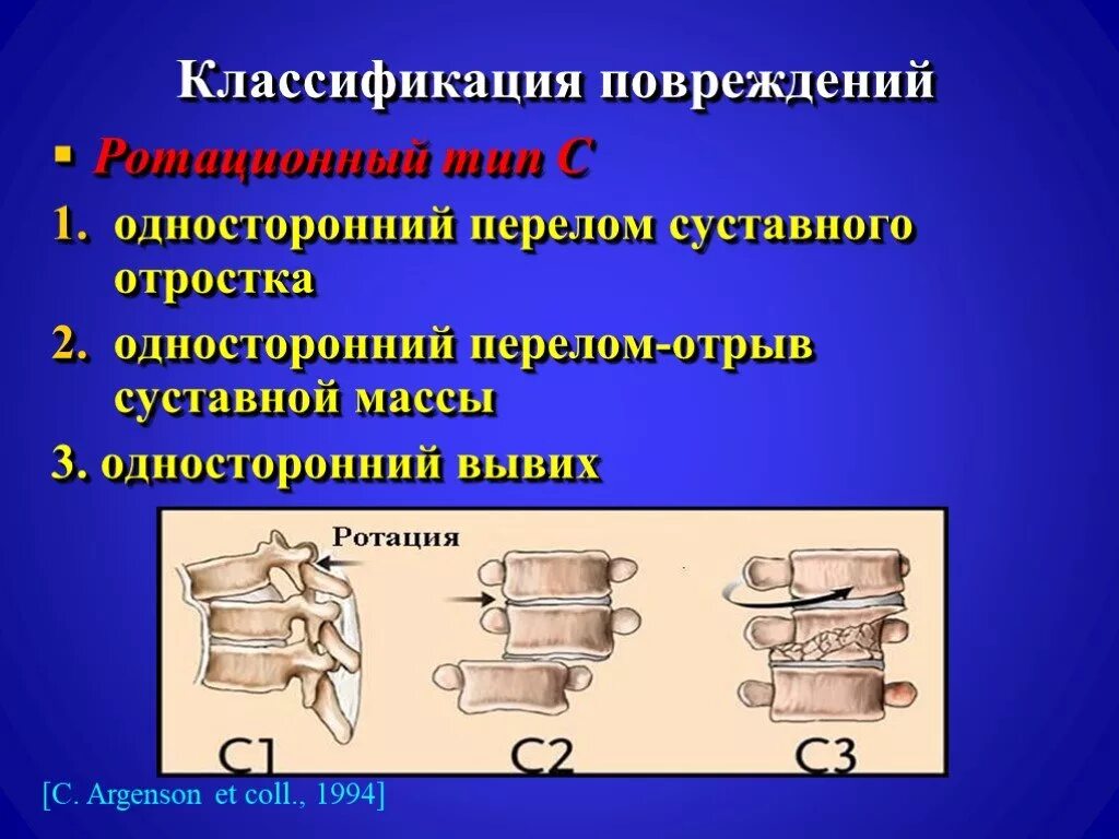 Повреждения позвоночника переломы. Переломы позвоночника классификация ao. Классификация повреждений позвоночника ao Spine. Классификация компрессионных переломов позвонков по АО. Компрессионные переломы тел позвонков классификация.