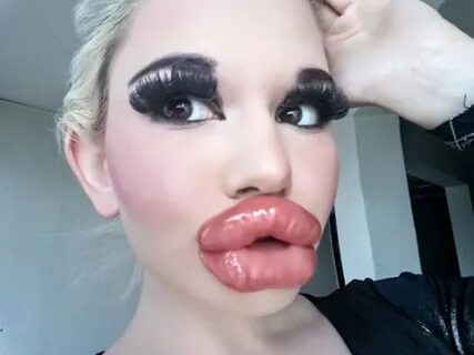 Больно есть": накачавшая самые большие губы в мире девушка пожаловалас...