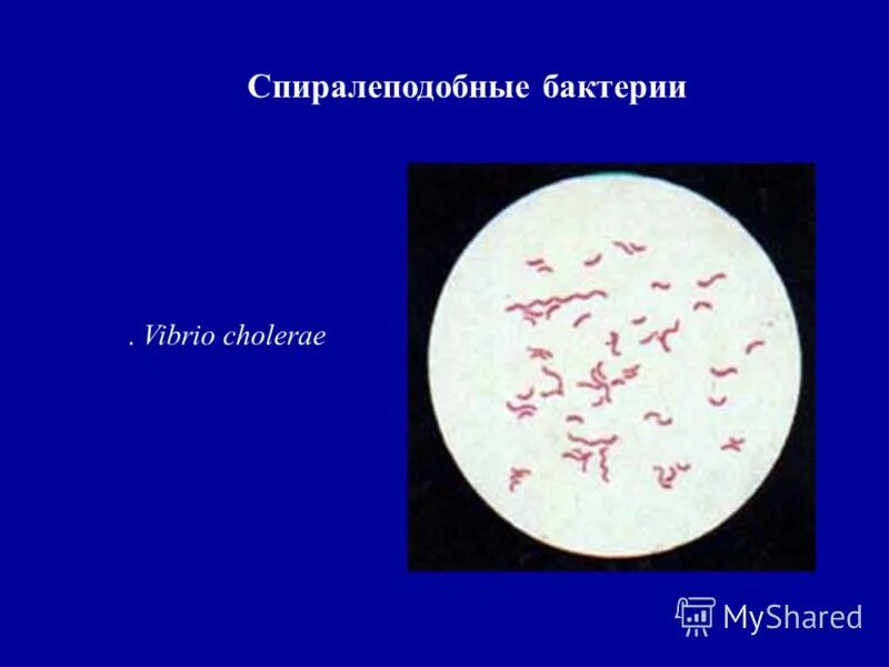 Трутовик окаймленный холерный вибрион. Vibrio cholerae микробиология. Вибрионы микробиология. Vibrio cholerae колонии. Vibrio cholerae микробиология характеристика.