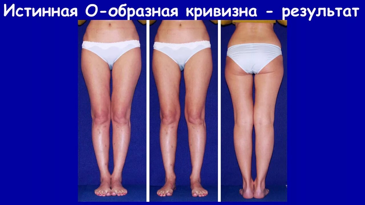 Как должны выглядеть идеальные ноги Маленькое черное платье и колготки  Дзен