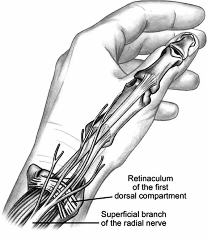 стилоидит лучевой кости. стилоидит лучезапястного сустава лечение. лучезапястный сустав стилоидиты. стилоидит лучезапястного сустава лечение. стилоидит лучезапястного сустава.