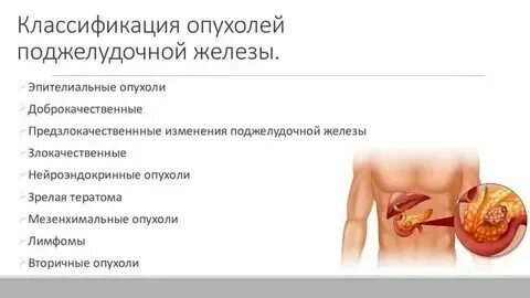 Как выглядит рак поджелудочной железы Nature: препарат от COVID-19 показал хорошие результаты при лечении рака поджелу