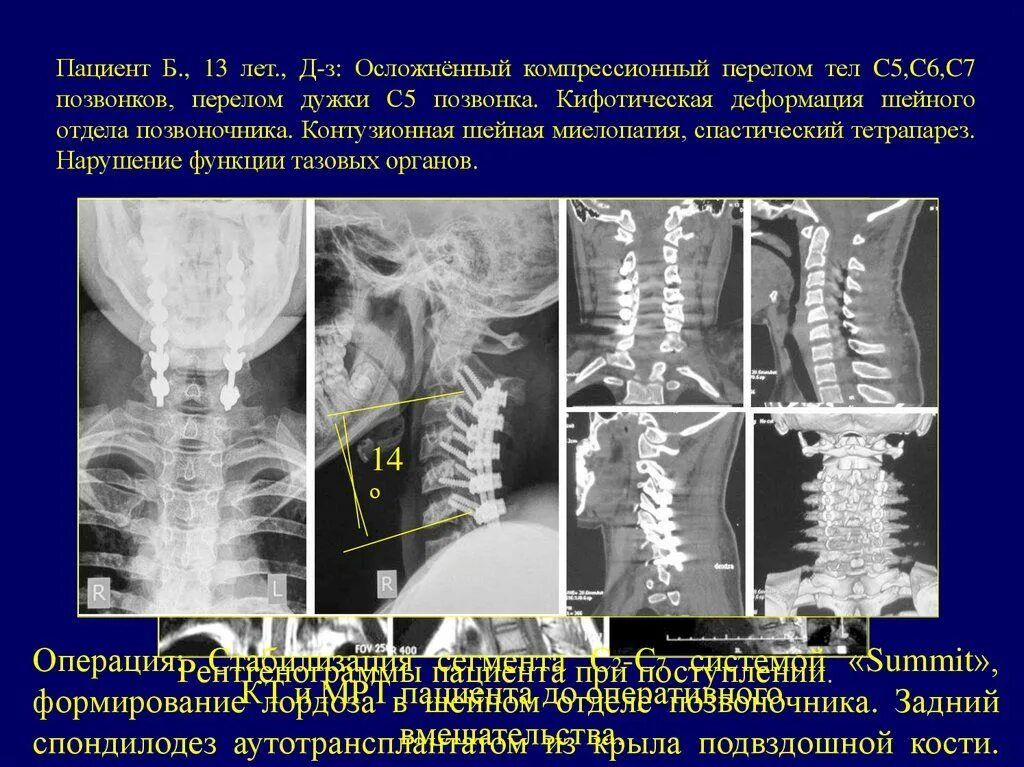 Сегмент с2 с3