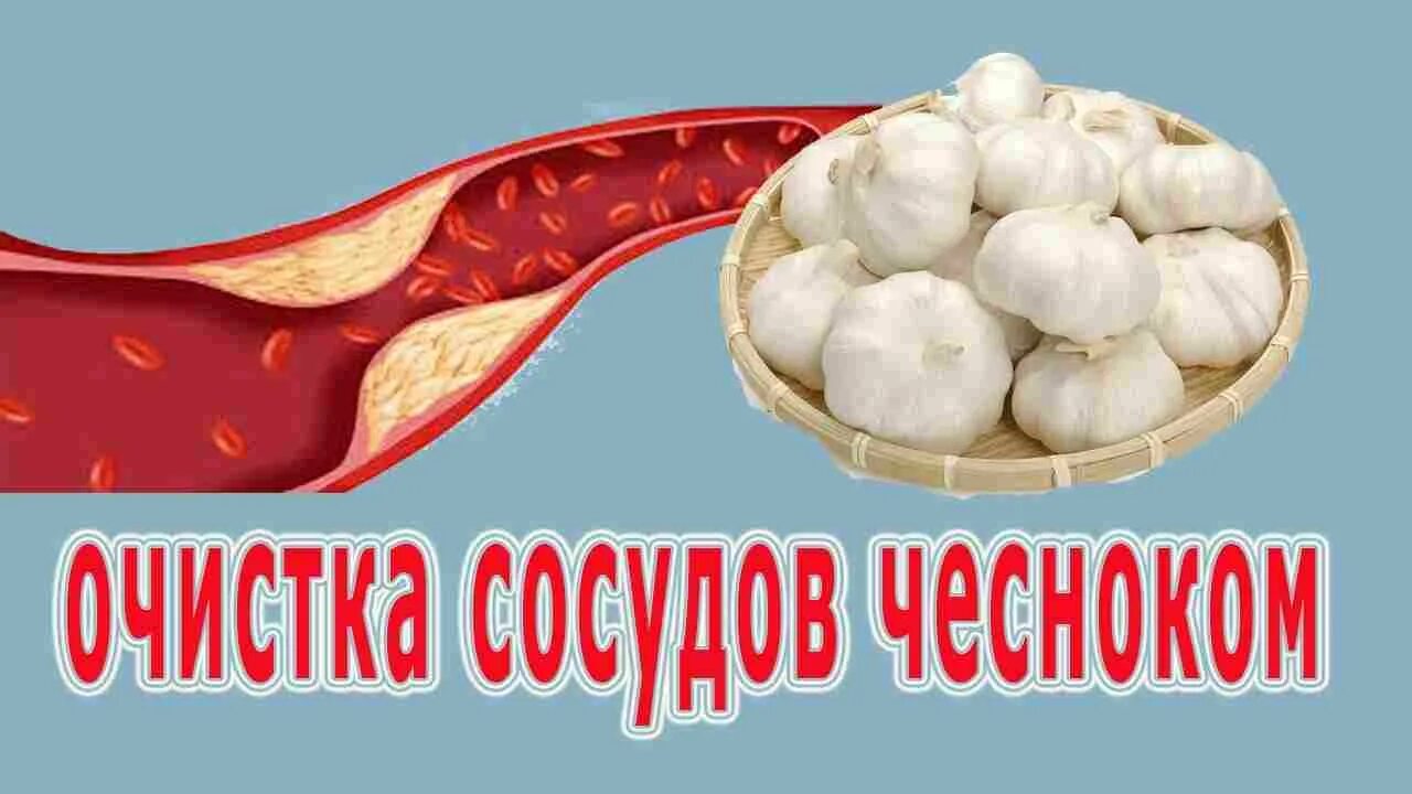 Головного мозга атеросклероз народное средство. Очищение сосудов чесноком. Чеснок для очищения сосудов головного мозга. Чеснок для сосудов очистки. Чеснок от холестерина.