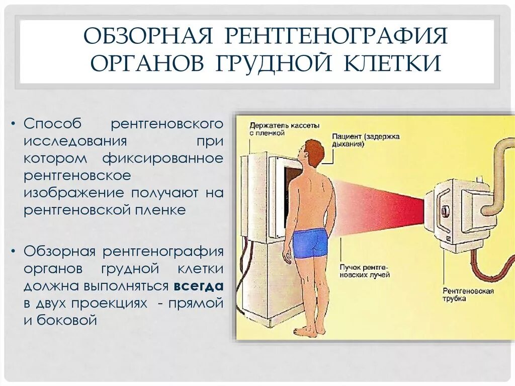 Исследование органов грудной клетки рентгеновские исследования. Подготовка к рентгенографии грудной клетки. Подготовка пациента к рентгенографии органов грудной клетки. Подготовка пациента к рентгеноскопии органов грудной клетки.