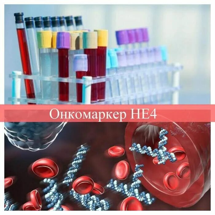 Онкомаркер са 4. Не-4 онкомаркер. пробирки для онкомаркеров. не4 онкомаркеры. опухолевый маркер не 4.