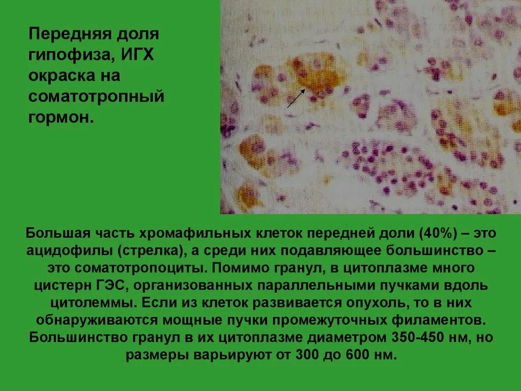 Базофильные клетки передней доли гипофиза. Базофильные клетки передней доли гипофиза. Хромофобные аденоциты гипофиза гистология. Гипофиз гистология препарат. Ацидофилы.