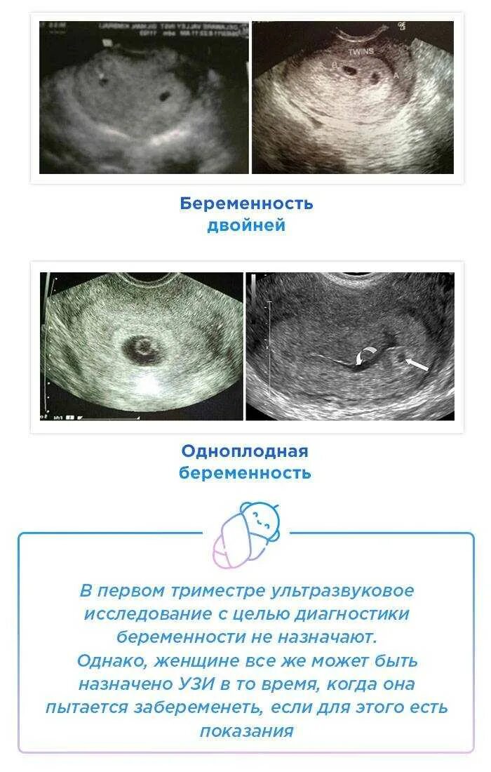 Беременность замершая симптомы признаки на раннем сроке. УЗИ 1-2 недели беременности на ранних сроках беременности. 1 Неделя беременности по УЗИ. УЗИ 1 неделя беременности замершей. Эмбрион на 1 неделе беременности УЗИ.