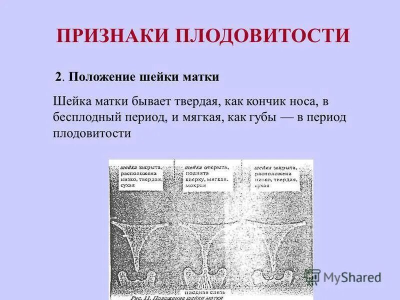 Почему пульсирует матка. Положение шейки матки. Положение шейки матки при беременности. Расположение шейки матки в цикле. Матка передьмесячными.