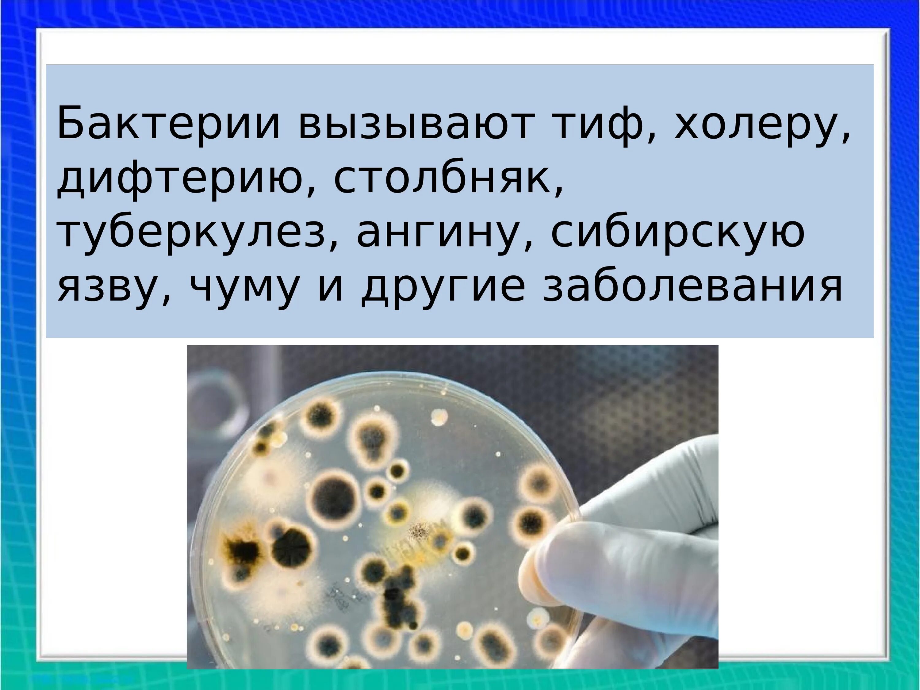 Какие болезни вызывающие бактериями вам известны. Болезни человека вызываемые бактериями. Бактерии вызывающие заболевания. Бактерии вызывающие холеру.