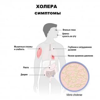 Холера какая инфекция