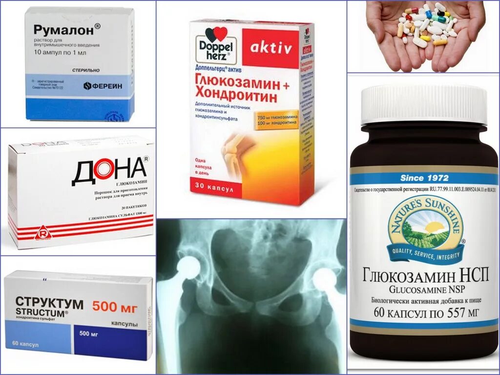 Какие обезболивающие при коксартрозе. Таблетки для коксартроза тазобедренного сустава. препараты при коксартрозе тазобедренного сустава 2. таблетки при коксартрозе тазобедренного сустава 1. таблетки коксартроз артроз.