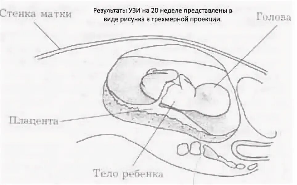 Расположение матки и мочевого пузыря. Расположение матки на 17 неделе. Расположение матки на 17-18 неделе. Где располагается матка на 20 неделе. Месторасположение матки в 17 недель.