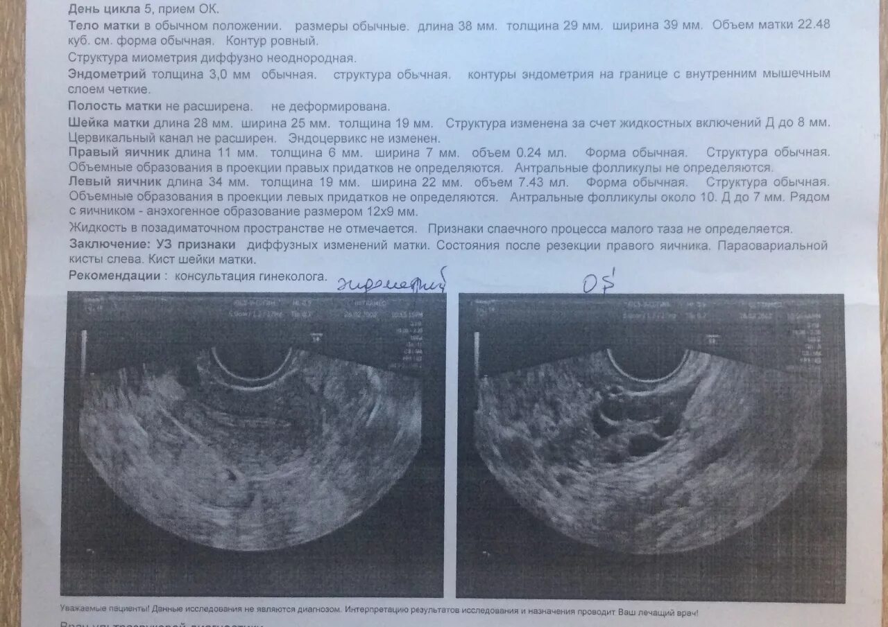 Норма полости матки. Матки эндометрий 12мм. Эндометрий на 5 день цикла по УЗИ. Эндометрий на УЗИ по дням цикла. Эндометрий матки норма мм.