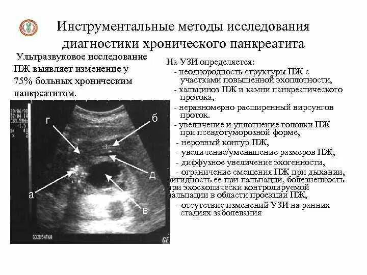 Обследования при панкреатите. Инструментальные методы исследования панкреатита. Хронический панкреатит УЗИ протокол. УЗИ поджелудочной железы при хроническом панкреатите заключение. УЗИ поджелудочной железы при панкреатите заключение.