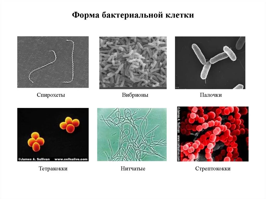 Бактерии известные виды. Формы бактериальных клеток спирохеты. Формы клетки бактерий спирохеты. Формы бактериальных клеток 5 класс биология. Вибрионы спирохеты стафилококки палочки.