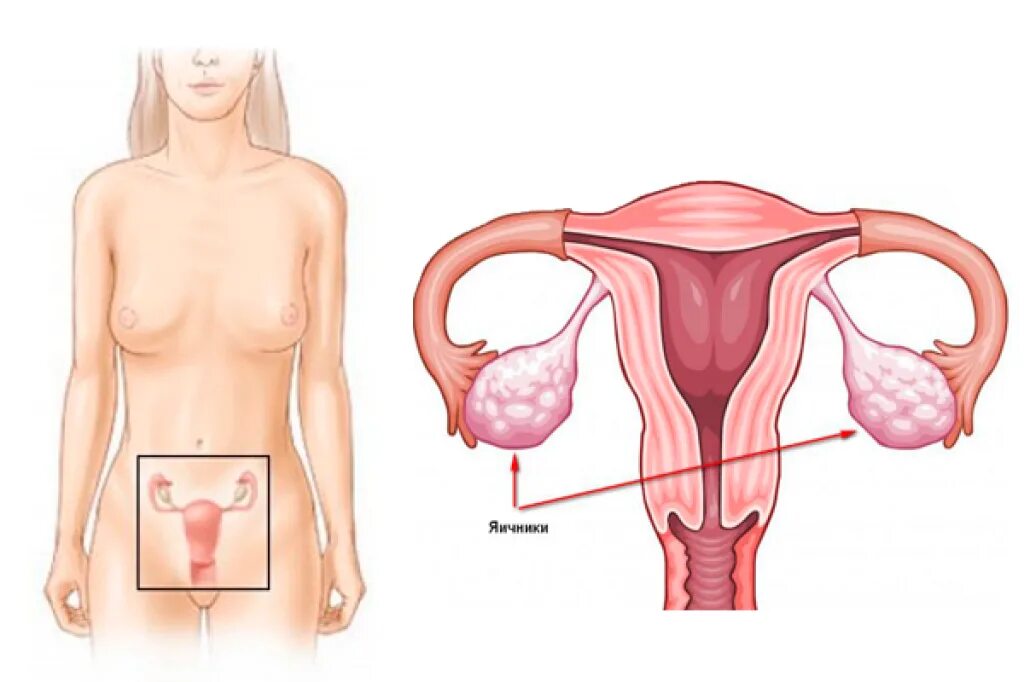 Яичники анатомия расположение. Матка с яичниками анатомия строение. Анатомия женщины матка и яичники. Расположение яичника и маточной трубы.
