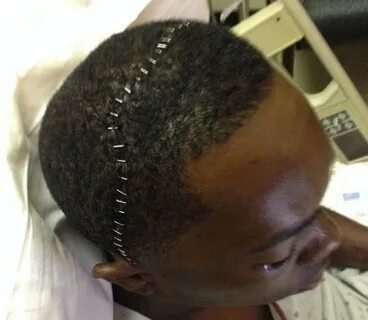 Head am