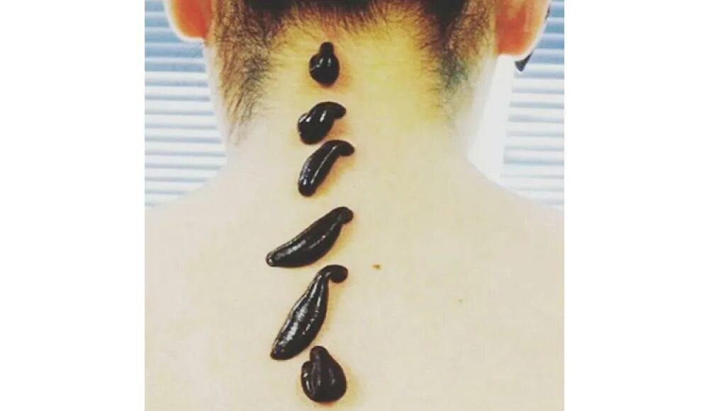 Лечебный эффект гирудотерапии выражен в. Гирудотерапия механизм действия. Противопоказания для постановки пиявок. Ольга герман гирудотерапия. Оказания для постановки пиявок:.