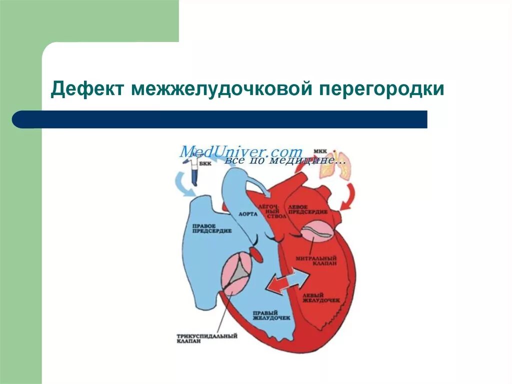 У какого животного имеется неполная межжелудочковая перегородка