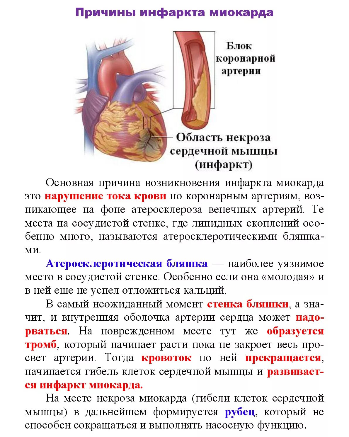 Инфаркт миокарда - признаки, причины, симптомы, лечение и профилактика - iDoctor