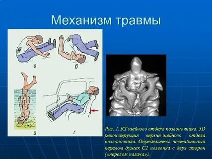 Механизм повреждения
