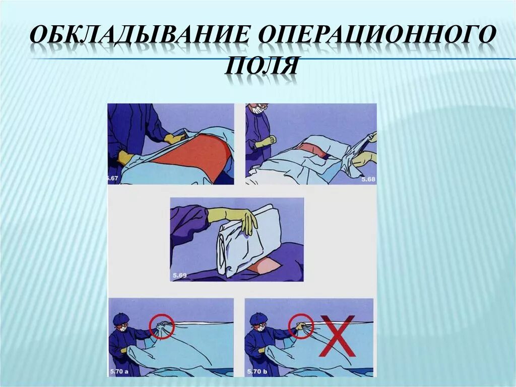 Обработка операционного поля. Подготовка операционного поля. Обработка операционного поля алгоритм. Этапы подготовки операционного поля.