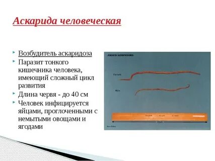 Возбудителем аскаридоза является