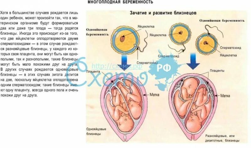 Схема ведения многоплодной беременности. Классификация многоплодной беременности. Оплодотворение двойняшек. Причины возникновения многоплодной беременности.