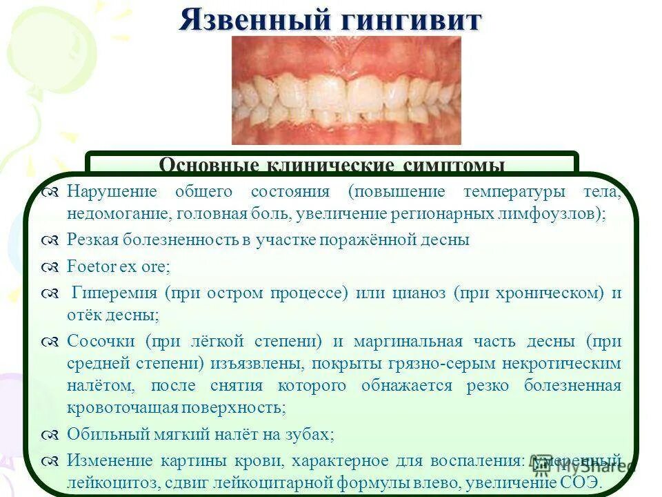 Наличие неприятно. Язвенно-некротический гингивит-пародонтит. Острый катаральный гингивит. Катаральное воспаление десен. Некротизирующий язвенный гингивит.