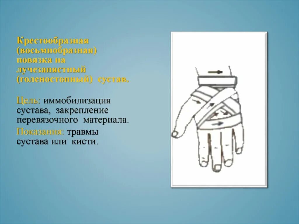 Повязка на кисть алгоритм. Десмургия лучезапястный сустав. Восьмиобразная повязка на лучезапястный сустав. Крестообразная повязка на лучезапястный сустав. Восьмиобразная повязка на лучезапястный сустав алгоритм.