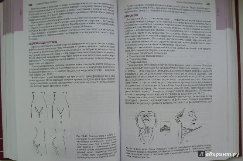 Национальное клиническое руководство. Хирургия национальное руководство. Клиническая хирургия национальное руководство. Абдоминальная хирургия национальное руководство. Клиническая хирургия национальное руководство в 3-х.