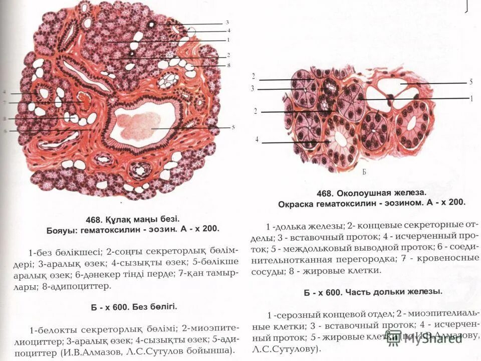 Правая околоушная железа